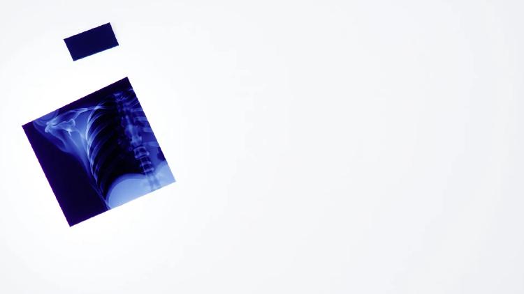 AI Models Pass Vision Tests Without Seeing the Images